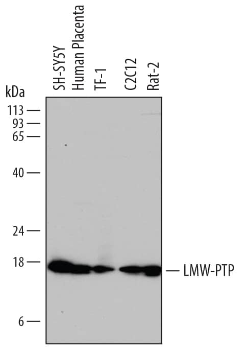 Western Blot LMW-PTP/ACP1 Antibody