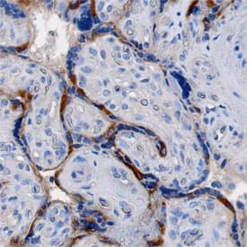 Immunohistochemistry LOX-1/OLR1 Antibody [Unconjugated]