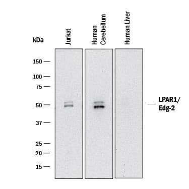 Western blot shows lysates of Jurkat human acute T cell leukemia cell line, human brain (cerebellum) tissue, and human liver tissue (negative control). PVDF membrane was probed with 2 µg/mL of Goat Anti-Human LPAR1/LPA1/EDG-2 Antigen Affinity-purified Polyclonal Antibody (Catalog # AF9963) followed by HRP-conjugated Anti-Goat IgG Secondary Antibody (Catalog # HAF017). Specific bands were detected for LPAR1/LPA1/EDG-2 at approximately 48-51 kDa (as indicated). This experiment was conducted under reducing conditions and using Immunoblot Buffer Group 1.