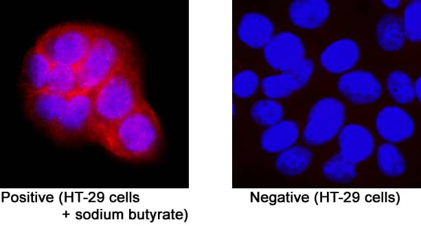 Immunocytochemistry LPAR5/LPA5/GPR92 Antibody (459812) [Unconjugated]