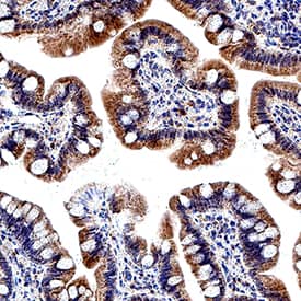 Immunohistochemistry LPAR5/LPA5/GPR92 Antibody (459812) [Unconjugated]