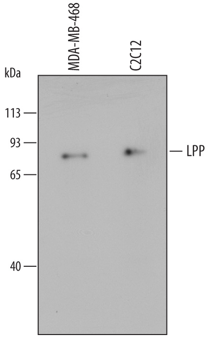 Western blot shows lysates of MDA-MB-468 human breast cancer cell line and C2C12 mouse myoblast cell line. PVDF membrane was probed with 0.5 µg/mL of Mouse Anti-Human LPP Monoclonal Antibody (Catalog # MAB6927) followed by HRP-conjugated Anti-Mouse IgG Secondary Antibody (Catalog # HAF007). A specific band was detected for LPP at approximately 80 kDa (as indicated). This experiment was conducted under reducing conditions and using Immunoblot Buffer Group 1.