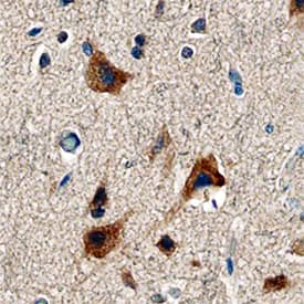LRG1 was detected in immersion fixed paraffin-embedded sections of human brain (cortex) using Sheep Anti-Human LRG1 Antigen Affinity-purified Polyclonal Antibody (Catalog # AF7890) at 3 µg/mL overnight at 4 °C. Tissue was stained using the Anti-Sheep HRP-DAB Cell & Tissue Staining Kit (brown; Catalog # CTS019) and counterstained with hematoxylin (blue). Specific staining was localized to neurons. View our protocol for Chromogenic IHC Staining of Paraffin-embedded Tissue Sections.