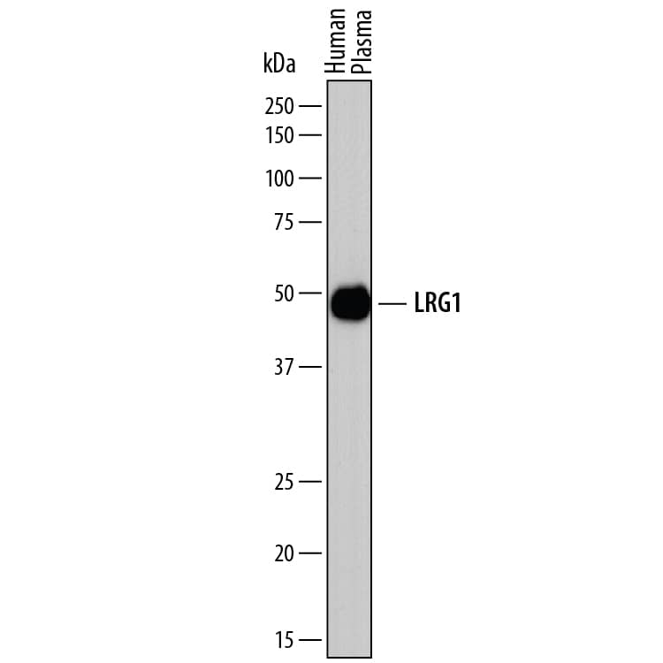Western blot shows human plasma. PVDF membrane was probed with 2 µg/mL of Sheep Anti-Human LRG1 Antigen Affinity-purified Polyclonal Antibody (Catalog # AF7890) followed by HRP-conjugated Anti-Sheep IgG Secondary Antibody (Catalog # HAF016). A specific band was detected for LRG1 at approximately 48-50 kDa (as indicated). This experiment was conducted under reducing conditions and using Immunoblot Buffer Group 1.