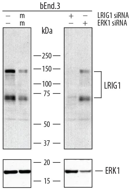 Western blot shows lysates of bEnd.3 mouse endothelioma cell line untreated (-), treated (+) or mock treated (m) with 30 pmol mouse LRIG1 or mouse ERK1 siRNA. PVDF membrane was probed with 2 µg/mL of Goat Anti-Mouse LRIG1 Antigen Affinity-purified Polyclonal Antibody (Catalog # AF3688) followed by HRP-conjugated Anti-Goat IgG Secondary Antibody (Catalog # HAF109). Specific bands were detected for LRIG1 at approximately 140 kDa and 70 kDa (as indicated, upper panel). For additional reference ERK1 was detected using Rabbit Anti-Human/Mouse/Rat ERK1 Antigen Affinity-purified Polyclonal Antibody (lower panel, Catalog # AF1575) This experiment was conducted under reducing conditions and using Immunoblot Buffer Group 1.