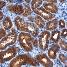 LRIG1 was detected in immersion fixed paraffin-embedded sections of human kidney using Mouse Anti-Human LRIG1 Monoclonal Antibody (Catalog # MAB7498) at 15 µg/mL overnight at 4 °C. Before incubation with the primary antibody, tissue was subjected to heat-induced epitope retrieval using Antigen Retrieval Reagent-Basic (Catalog # CTS013). Tissue was stained using the Anti-Mouse HRP-DAB Cell & Tissue Staining Kit (brown; Catalog # CTS002) and counter-stained with hematoxylin (blue). Specific staining was localized to cytoplasm of epithelial cells in convoluted tubules. View our protocol for Chromogenic IHC Staining of Paraffin-embedded Tissue Sections.