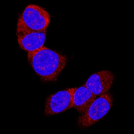 LRIG2 was detected in immersion fixed WM-115 human malignant melanoma cell line using Mouse Anti-Human LRIG2 Monoclonal Antibody (Catalog # MAB19411) at 8 µg/mL for 3 hours at room temperature. Cells were stained using the NorthernLights™ 557-conjugated Anti-Mouse IgG Secondary Antibody (red; Catalog # NL007) and counterstained with DAPI (blue). Specific staining was localized to cytoplasm and cell surfaces. View our protocol for Fluorescent ICC Staining of Cells on Coverslips.