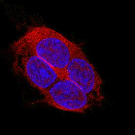 LRIG2 was detected in immersion fixed WM-115 human malignant melanoma cell line using Mouse Anti-Human LRIG2 Monoclonal Antibody (Catalog # MAB1941) at 8 µg/mL for 3 hours at room temperature. Cells were stained using the NorthernLights™ 557-conjugated Anti-Mouse IgG Secondary Antibody (red; Catalog # NL007) and counterstained with DAPI (blue). Specific staining was localized to cytoplasm. View our protocol for Fluorescent ICC Staining of Cells on Coverslips.