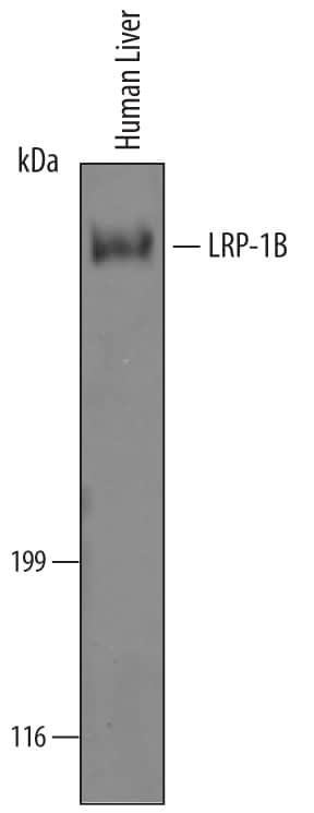 Western Blot LRP-1B Antibody