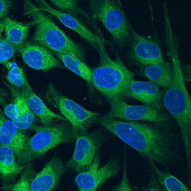 LRP-1 Cluster III was detected in immersion fixed MG-63 human osteosarcoma cell line using Sheep Anti-Human LRP-1 Cluster III Antigen Affinity-purified Polyclonal Antibody (Catalog # AF4824) at 10 µg/mL for 3 hours at room temperature. Cells were stained using the NorthernLights™ 493-conjugated Anti-Sheep IgG Secondary Antibody (green; NL012) and counterstained with DAPI (blue). Specific staining was localized to cytoplasm. View our protocol for Fluorescent ICC Staining of Cells on Coverslips.