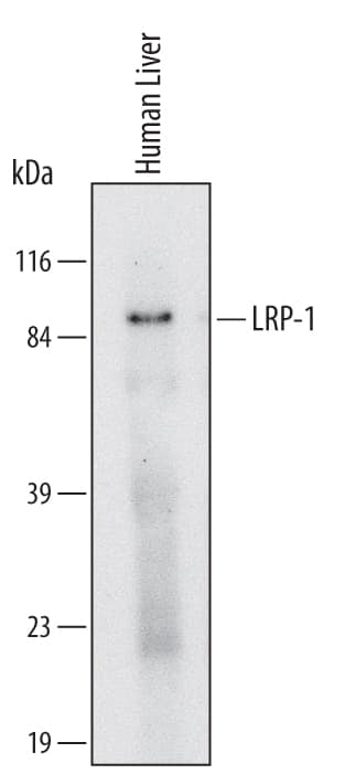 Western blot shows lysates of human liver tissue. PVDF Membrane was probed with 2 µg/mL of Human LRP-1 beta subunit Monoclonal Antibody (Catalog # MAB6360) followed by HRP-conjugated Anti-Mouse IgG Secondary Antibody (Catalog # HAF007). A specific band was detected for LRP-1 at approximately 90 kDa (as indicated). This experiment was conducted under reducing conditions and using Immunoblot Buffer Group 1.