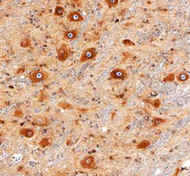 LRP-4 was detected in immersion fixed paraffin-embedded sections of human brainstem using Sheep Anti-Human/Rat LRP-4 Antigen Affinity-purified Polyclonal Antibody (Catalog # AF5948) at 3 µg/mL overnight at 4 °C. Tissue was stained using the Anti-Sheep HRP-DAB Cell & Tissue Staining Kit (brown; Catalog # CTS019) and counterstained with hematoxylin (blue). Specific staining was localized to neuronal cell bodies and processes. This application has not been tested in rat samples. View our protocol for Chromogenic IHC Staining of Paraffin-embedded Tissue Sections.