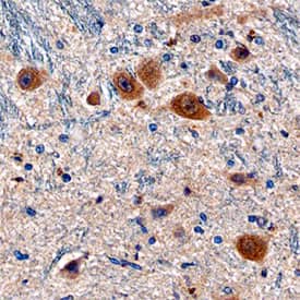Immunohistochemistry LRP-4 Antibody (741704) [Unconjugated]