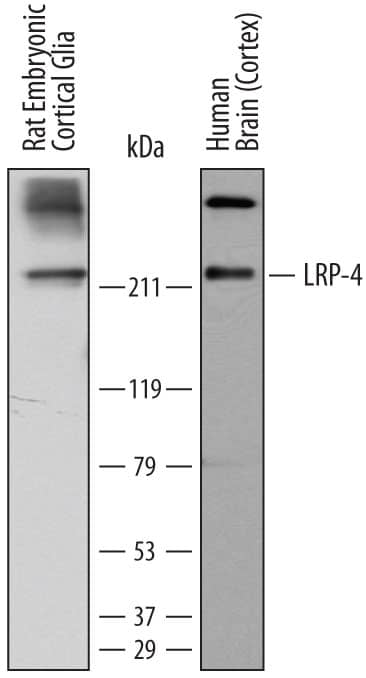 Western Blot LRP-4 Antibody (741704) [Unconjugated]