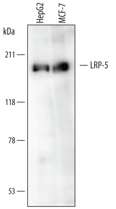 Western Blot LRP-5 Antibody (747619)
