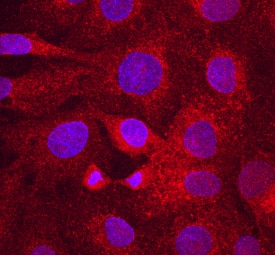 LRP-6 was detected in immersion fixed DU145 human prostate carcinoma cell line using Mouse Anti-Human LRP-6 Monoclonal Antibody (Catalog # MAB1505) at 10 µg/mL for 3 hours at room temperature. Cells were stained using the NorthernLights™ 557-conjugated Anti-Mouse IgG Secondary Antibody (red; Catalog # NL007) and counterstained with DAPI (blue). Specific staining was localized to cell surfaces and cytoplasm. View our protocol for Fluorescent ICC Staining of Cells on Coverslips.