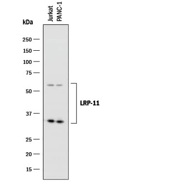 Western Blot LRP-11 Antibody