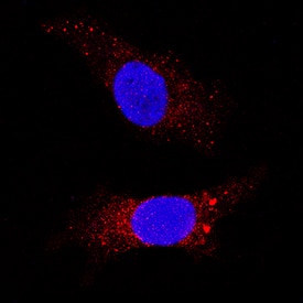 LRP-1 Cluster II was detected in immersion fixed HepG2 human hepatocellular carcinoma cell line using Goat Anti-Human LRP-1 Cluster II Antigen Affinity-purified Polyclonal Antibody (Catalog # AF2368) at 3 µg/mL for 3 hours at room temperature. Cells were stained using the NorthernLights™ 557-conjugated Anti-Goat IgG Secondary Antibody (red; NL001) and counterstained with DAPI (blue). Specific staining was localized to cytoplasm and nuclei. View our protocol for Fluorescent ICC Staining of Cells on Coverslips.