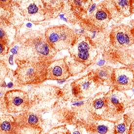 LRP-1 Cluster II was detected in immersion fixed paraffin-embedded sections of human liver using Goat Anti-Human LRP-1 Cluster II Antigen Affinity-purified Polyclonal Antibody (Catalog # AF2368) at 3 µg/mL for 1 hour at room temperature followed by incubation with the Anti-Goat IgG VisUCyte™ HRP Polymer Antibody (VC004). Tissue was stained using DAB (brown) and counterstained with hematoxylin (blue). Specific staining was localized to cell membranes and cytoplasm. View our protocol for IHC Staining with VisUCyte HRP Polymer Detection Reagents.