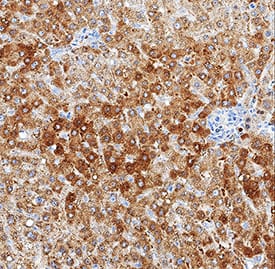 LRP-1 was detected in immersion fixed paraffin-embedded sections of human liver using Mouse Anti-Human LRP-1 beta subunit Monoclonal Antibody (Catalog # MAB6360) at 5 µg/mL for 1 hour at room temperature followed by incubation with the Anti-Mouse IgG VisUCyte™ HRP Polymer Antibody (Catalog # VC001). Tissue was stained using DAB (brown) and counterstained with hematoxylin (blue). Specific staining was localized to cytoplasm in hepatocytes. View our protocol for IHC Staining with VisUCyte HRP Polymer Detection Reagents.