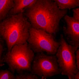 LRPAP was detected in immersion fixed A549 human lung carcinoma cell line using Goat Anti-Human LRPAP Antigen Affinity-purified Polyclonal Antibody (Catalog # AF4296) at 10 µg/mL for 3 hours at room temperature. Cells were stained using the NorthernLights™ 557-conjugated Anti-Goat IgG Secondary Antibody (red; Catalog # NL001) and counterstained with DAPI (blue). Specific staining was localized to Golgi and endoplasmic reticula. View our protocol for Fluorescent ICC Staining of Cells on Coverslips.