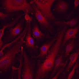 Immunocytochemistry LRRC32/GARP Antibody [Unconjugated]