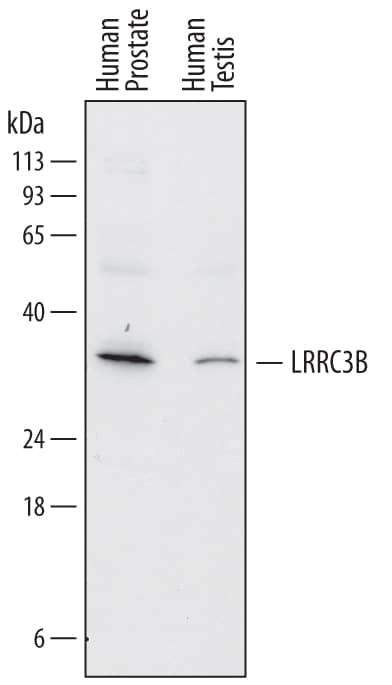 Western Blot LRRC3B/LRP15 Antibody (758315)