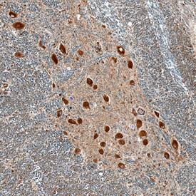 Immunohistochemistry LRRC3 Antibody