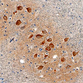 Immunohistochemistry LRRC3 Antibody (532820) [Unconjugated]