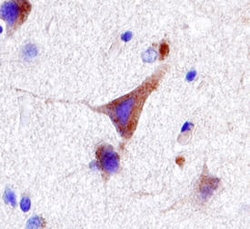 LRRK2 was detected in immersion fixed paraffin-embedded sections of human brain (cortex) using Human LRRK2 Antigen Affinity-purified Polyclonal Antibody (Catalog # AF6674) at 5 µg/mL overnight at 4 °C. Tissue was stained using the Anti-Goat HRP-DAB Cell & Tissue Staining Kit (brown; Catalog # CTS008) and counterstained with hemotoxylin (blue). Specific staining was localized to cytoplasm and processes of neuronal cells. View our protocol for Chromogenic IHC Staining of Paraffin-embedded Tissue Sections.