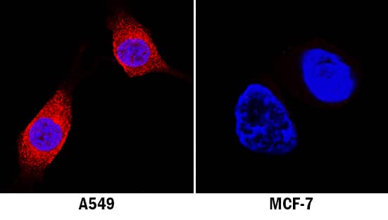 LRRK2 was detected in immersion fixed A549 human lung carcinoma cell line (positive staining) and MCF-7 human breast cancer cell line (negative staining) using Mouse Anti-Human LRRK2 Monoclonal Antibody (Catalog # MAB66741) at 8 µg/mL for 3 hours at room temperature. Cells were stained using the NorthernLights™ 557-conjugated Anti-Mouse IgG Secondary Antibody (red; Catalog # NL007) and counterstained with DAPI (blue). Specific staining was localized to cytoplasm. View our protocol for Fluorescent ICC Staining of Cells on Coverslips.