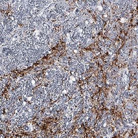 LRRK2 was detected in immersion fixed paraffin-embedded sections of human brain (substantia nigra) using Mouse Anti-Human LRRK2 Monoclonal Antibody (Catalog # MAB6674) at 5 µg/mL for 1 hour at room temperature followed by incubation with the Anti-Mouse IgG VisUCyte™ HRP Polymer Antibody (Catalog # VC001). Before incubation with the primary antibody, tissue was subjected to heat-induced epitope retrieval using Antigen Retrieval Reagent-Basic (Catalog # CTS013). Tissue was stained using DAB (brown) and counterstained with hematoxylin (blue). Specific staining was localized to neuronal processes. View our protocol for IHC Staining with VisUCyte HRP Polymer Detection Reagents.