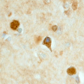 Immunohistochemistry LRRTM3 Antibody [Unconjugated]