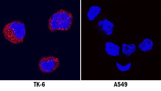 Immunocytochemistry LRTM1 Antibody (2381D) [Unconjugated]
