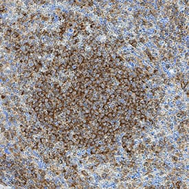 Immunohistochemistry LRTM1 Antibody (2381D) [Unconjugated]