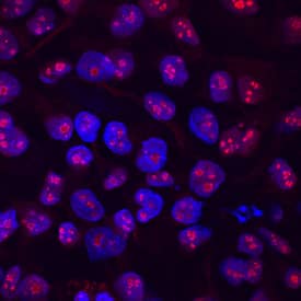 LYAR was detected in immersion fixed BG01V human embryonic stem cells using Sheep Anti-Human LYAR Antigen Affinity-purified Polyclonal Antibody (Catalog # AF6748) at 5 µg/mL for 3 hours at room temperature. Cells were stained using the NorthernLights™ 557-conjugated Anti-Sheep IgG Secondary Antibody (red; Catalog # <a class=