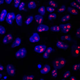 LYAR was detected in immersion fixed BG01V human embryonic stem cells using Mouse Anti-Human LYAR Monoclonal Antibody (Catalog # MAB6748) at 10 µg/mL for 3 hours at room temperature. Cells were stained using the NorthernLights™ 557-conjugated Anti-Mouse IgG Secondary Antibody (red; Catalog # <a class=