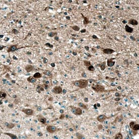 LYPD1 was detected in immersion fixed paraffin-embedded sections of human brain (hypothalamus) using Sheep Anti-Human LYPD1 Antigen Affinity-purified Polyclonal Antibody (Catalog # AF6855) at 10 µg/mL overnight at 4 °C. Before incubation with the primary antibody, tissue was subjected to heat-induced epitope retrieval using Antigen Retrieval Reagent-Basic (Catalog # CTS013). Tissue was stained using the Anti-Sheep HRP-DAB Cell & Tissue Staining Kit (brown; Catalog # CTS019) and counterstained with hematoxylin (blue). Specific staining was localized to neuronal cell bodies and processes. View our protocol for Chromogenic IHC Staining of Paraffin-embedded Tissue Sections.