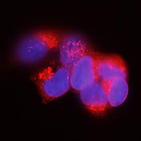 LYPD8 was detected in immersion fixed HEK293 human embryonic kidney cell line using Mouse Anti-Human LYPD8 Monoclonal Antibody (Catalog # MAB9087) at 5 µg/mL for 3 hours at room temperature. Cells were stained using the NorthernLights™ 557-conjugated Anti-Mouse IgG Secondary Antibody (red; Catalog # NL007) and counterstained with DAPI (blue). Specific staining was localized to cell membrane and cytoplasm. View our protocol for Fluorescent ICC Staining of Cells on Coverslips.