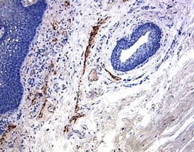 LYVE‑1 was detected in immersion fixed paraffin-embedded sections of human tonsil using 15 &micro;g/mL Goat Anti-Human LYVE‑1 Antigen Affinity-purified Polyclonal Antibody (Catalog # AF2089) overnight at 4 &deg;C. Tissue was stained with the Anti-Goat HRP-DAB Cell & Tissue Staining Kit (brown; Catalog # CTS008) and counterstained with hematoxylin (blue). View our protocol for Chromogenic IHC Staining of Paraffin-embedded Tissue Sections.