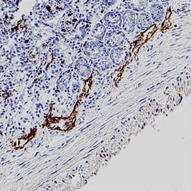 LYVE-1 was detected in immersion fixed frozen sections of mouse intestine tissue using Rat Anti-Mouse LYVE-1 Monoclonal Antibody (Catalog # MAB2125) at 15 µg/mL for 1 hour at room temperature followed by incubation with the Anti-Rat IgG VisUCyte™ HRP Polymer Antibody (VC005). Tissue was stained using DAB (brown) and counterstained with hematoxylin (blue). Specific staining was localized to endothelial cells in lymphatic vessels. View our protocol for IHC Staining with VisUCyte HRP Polymer Detection Reagents.