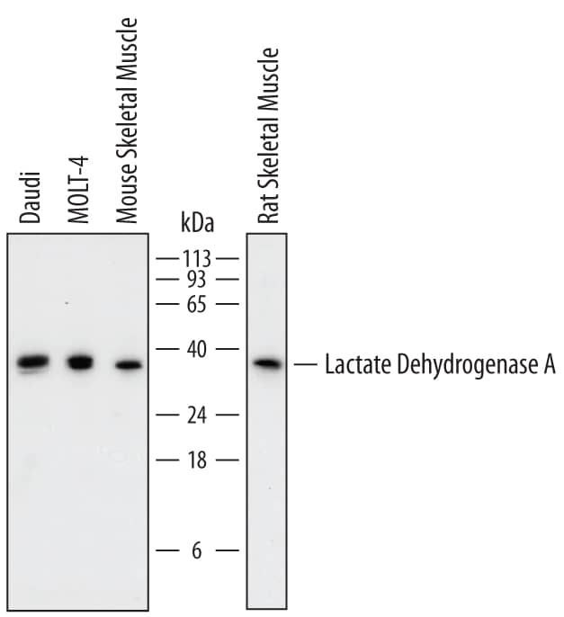 Western blot shows lysates of Daudi human Burkitt's lymphoma cell line, MOLT-4 human acute lymphoblastic leukemia cell line, mouse skeletal muscle tissue, and rat skeletal muscle tissue. PVDF membrane was probed with 0.5 µg/mL of Sheep Anti-Human/Mouse/Rat Lactate Dehydrogenase A/LDHA Antigen Affinity-purified Polyclonal Antibody (Catalog # AF7304) followed by HRP-conjugated Anti-Sheep IgG Secondary Antibody (Catalog # HAF016). A specific band was detected for Lactate Dehydrogenase A/LDHA at approximately 36 kDa (as indicated). This experiment was conducted under reducing conditions and using Immunoblot Buffer Group 1.