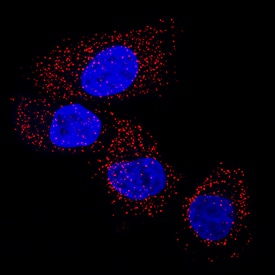 Immunocytochemistry Lactate Dehydrogenase A/LDHA Antibody (2066C) [Unconjugated]