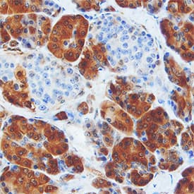 Immunohistochemistry Lactate Dehydrogenase A/LDHA Antibody (2066C) [Unconjugated]
