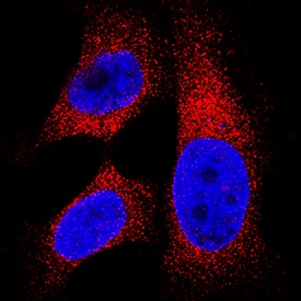 Lactate Dehydrogenase B/LDHB was detected in immersion fixed HeLa human cervical epithelial carcinoma cell line using Rabbit Anti-Human Lactate Dehydrogenase B/LDHB Monoclonal Antibody (Catalog # MAB9205) at 3 µg/mL for 3 hours at room temperature. Cells were stained using the NorthernLights™ 557-conjugated Anti-Rabbit IgG Secondary Antibody (red; Catalog # NL004) and counterstained with DAPI (blue). Specific staining was localized to cytoplasm. View our protocol for Fluorescent ICC Staining of Cells on Coverslips.