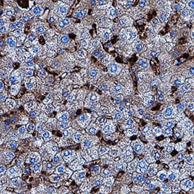 Lactate Dehydrogenase B/LDHB was detected in immersion fixed paraffin-embedded sections of human liver using Rabbit Anti-Human Lactate Dehydrogenase B/LDHB Monoclonal Antibody (Catalog # MAB9205) at 1 µg/mL for 1 hour at room temperature followed by incubation with the Anti-Rabbit IgG VisUCyte™ HRP Polymer Antibody (Catalog # VC003). Tissue was stained using DAB (brown) and counterstained with hematoxylin (blue). Specific staining was localized to sinusoids. View our protocol for IHC Staining with VisUCyte HRP Polymer Detection Reagents.
