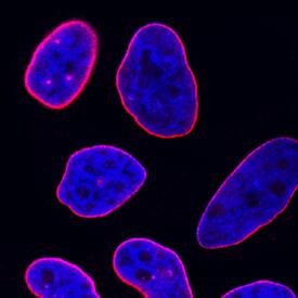 Lamin B1 was detected in immersion fixed HeLa human cervical epithelial carcinoma cell line using Mouse Anti-Human Lamin B1 Monoclonal Antibody (Catalog # MAB8525) at 8 µg/mL for 3 hours at room temperature. Cells were stained using the NorthernLights™ 557-conjugated Anti-Mouse IgG Secondary Antibody (red; Catalog # NL007) and counterstained with DAPI (blue). Specific staining was localized to nuclear membrane. View our protocol for Fluorescent ICC Staining of Cells on Coverslips.