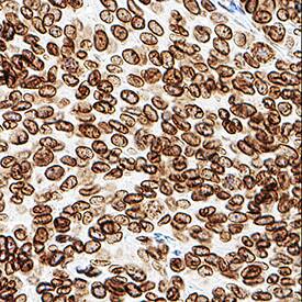 Lamin B1 was detected in immersion fixed paraffin-embedded sections of human liver using Mouse Anti-Human Lamin B1 Monoclonal Antibody (Catalog # MAB8525) at 3 µg/mL for 1 hour at room temperature followed by incubation with the Anti-Mouse IgG VisUCyte™ HRP Polymer Antibody (Catalog # VC001). Tissue was stained using DAB (brown) and counterstained with hematoxylin (blue). Specific staining was localized to nuclear membrane. View our protocol for IHC Staining with VisUCyte HRP Polymer Detection Reagents.