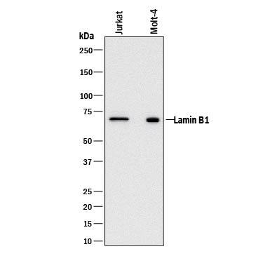 Western blot shows lysates of Jurkat human acute T cell leukemia cell line and MOLT-4 human acute lymphoblastic leukemia cell line. PVDF membrane was probed with 2 µg/mL of Mouse Anti-Human Lamin B1 Monoclonal Antibody (Catalog # MAB8525) followed by HRP-conjugated Anti-Mouse IgG Secondary Antibody (Catalog # HAF018). A specific band was detected for Lamin B1 at approximately 68 kDa (as indicated). This experiment was conducted under reducing conditions and using Immunoblot Buffer Group 1.