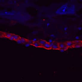 Laminin-1 was detected in immersion fixed frozen sections of embryonic mouse parietal endoderm (E10.5) using Mouse Laminin-1 Monoclonal Antibody (Catalog # MAB2549) at 10 µg/mL overnight at 4 °C. Tissue was stained using the NorthernLights™ 637-conjugated Anti-Rat IgG Secondary Antibody (red; Catalog # NL014) and counterstained with DAPI (blue). View our protocol for Fluorescent IHC Staining of Frozen Tissue Sections.
